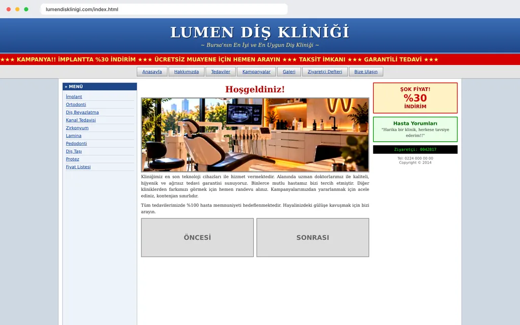 Lumen Diş Kliniği için eski web sitesi yenileme görünümü